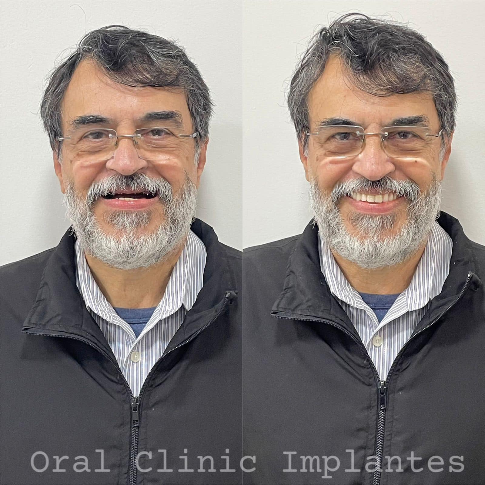reabilitação oral Osasco clínica de reabilitação oral km 18 Osasco dentista especializado em reabilitação oral Osasco